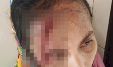 Saksi Tidak Mau Bersumpah Memberikan Kesaksian Palsu "Ada Apa Dengan PN Lubuk Pakam Kab. Deli Serdang Yusniar Mengalami Penganiayaan Saksi Yang Hadir Memberikan Kesaksian Palsu