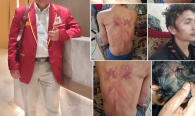 Sebulan Laporan Penganiayaan di Polrestabes Medan Belum Terungkap, Ketua PPN Kota Medan : Polri Punya Keahlian Mengungkap Kasus Ini