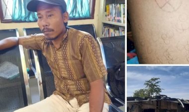 Safri Korban Peluru Nyasar Senapan Angin Meminta Bantuan Kepada Kapolres Belawan 