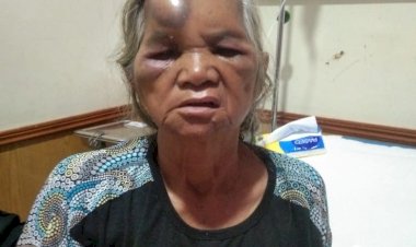 Korban Supir Box Pengantar Barang Indomaret Yang Tak Bertanggung Jawab